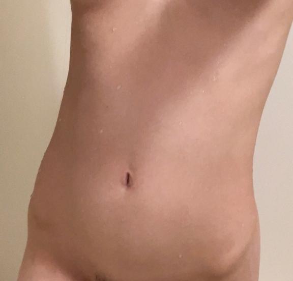 急遽！