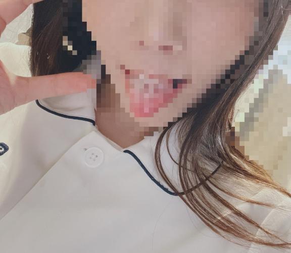 ❤️‍🩹治療❤️‍🩹治療❤️‍🩹治療❤️‍🩹治療❤️‍🩹治療❤️‍🩹