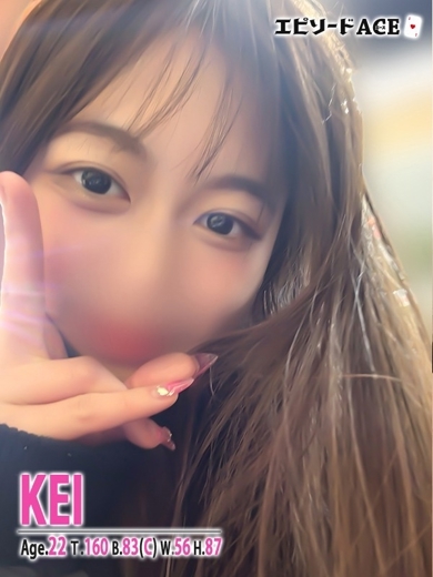 エピソードACE 한국인 가능 소프랜드 KEI