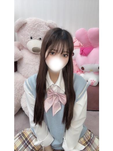  MIO