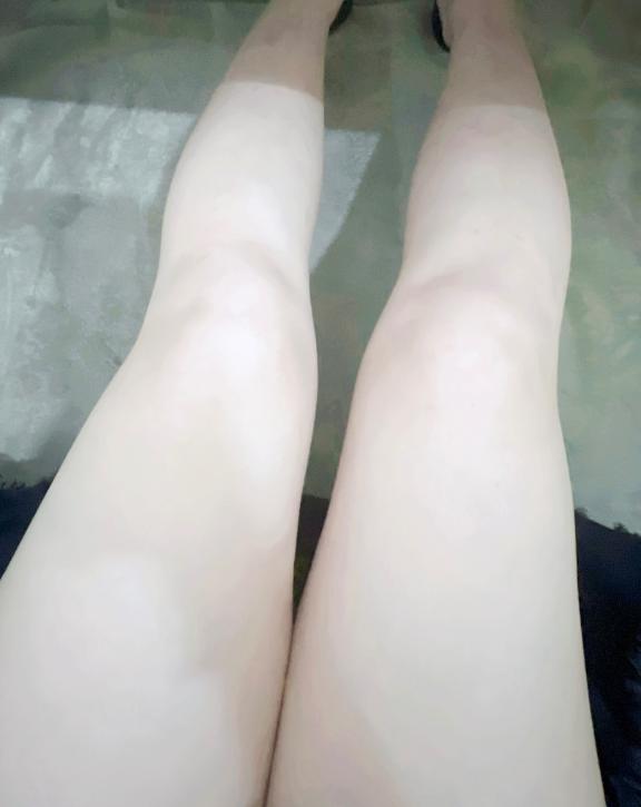 いやし